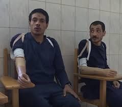 تركيب أطراف صناعية للسجناء تركيب أطراف صناعية للسجناء